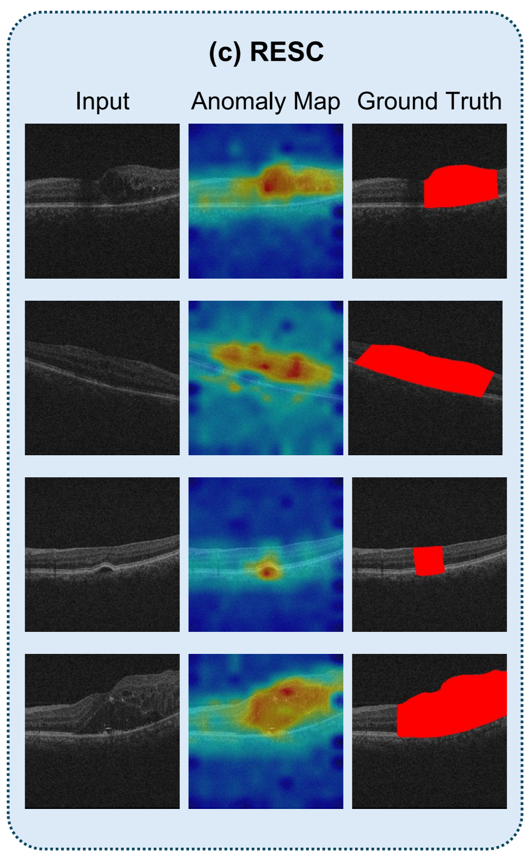 Medical Anomaly Rip Few-shot Medical Anomaly Detection through Centroid Consultation Back ...
