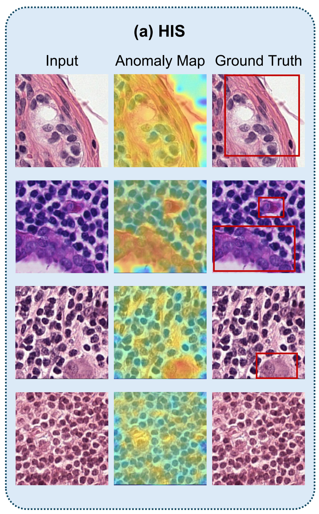 Pathological Map Geometry Few-shot Medical Anomaly Detection through Centroid Consultation Back ...