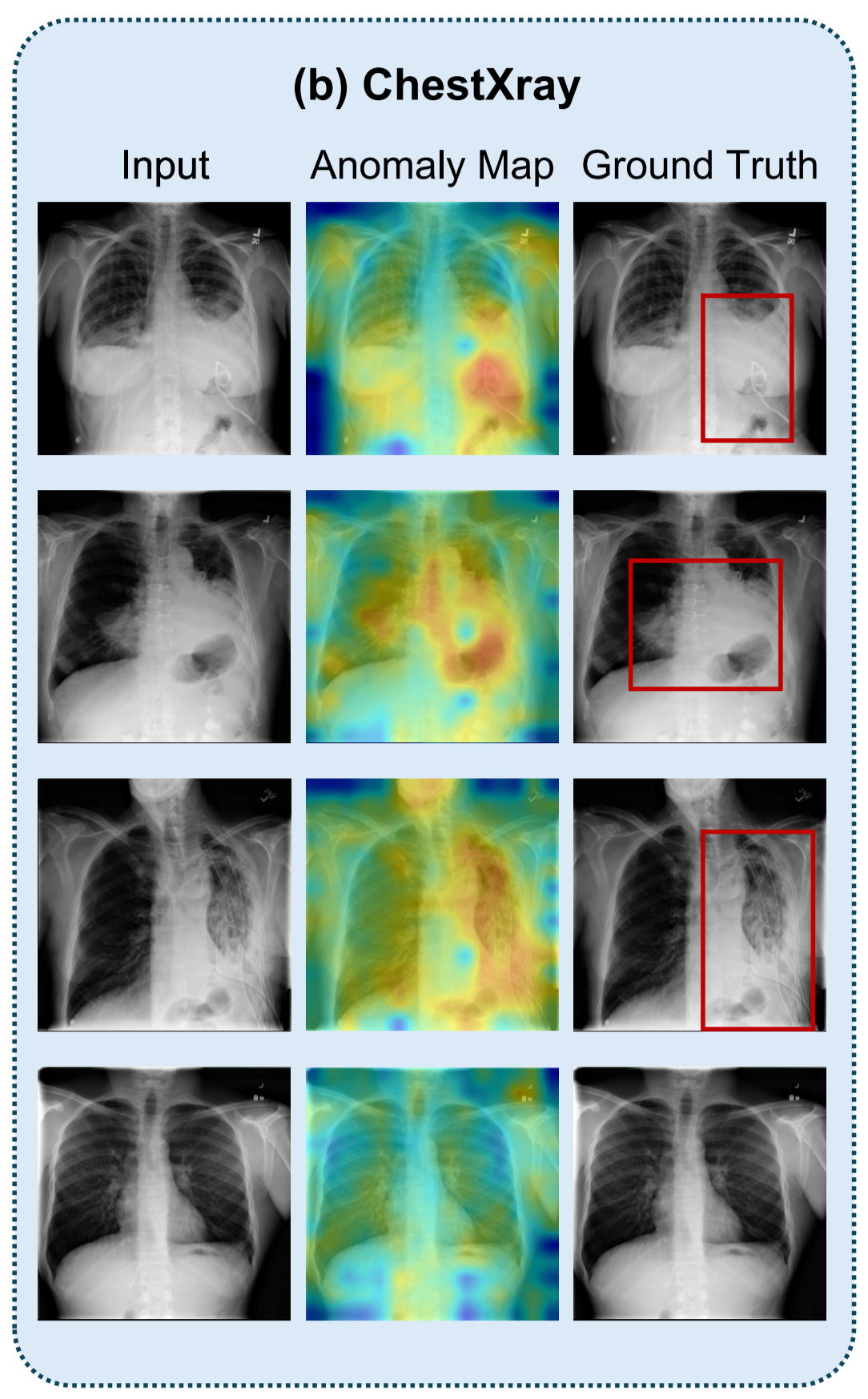 Medical Anomaly Rip Few-shot Medical Anomaly Detection through Centroid Consultation Back ...