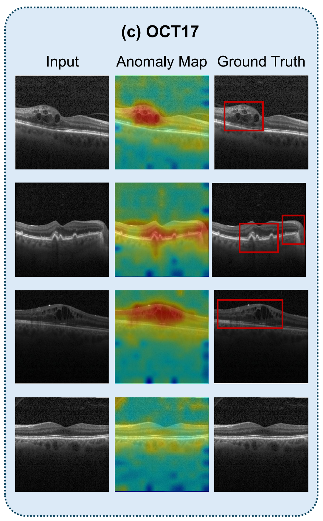 Medical Anomaly Rip Few-shot Medical Anomaly Detection through Centroid Consultation Back ...